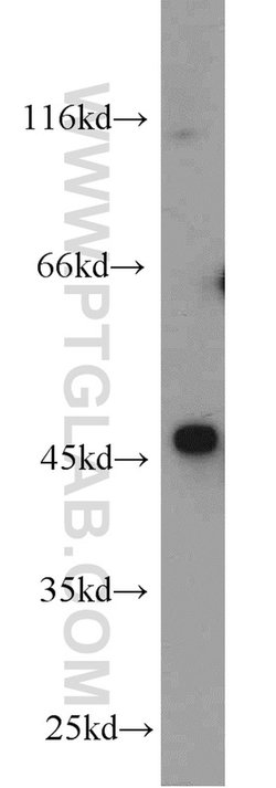 Oxytocin Receptor Rabbit anti-Human, Polyclonal, Proteintech:Antibodies:Primary