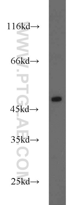 Oxytocin Receptor Rabbit anti-Human, Polyclonal, Proteintech:Antibodies:Primary