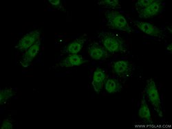 FOXC2 Rabbit anti-Human, Mouse, Rat, Polyclonal, Proteintech 150 &mu;L;