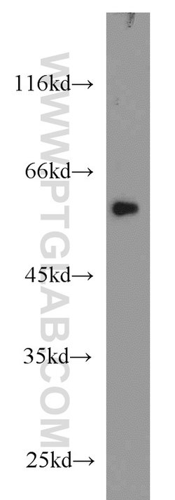 FOXC2 Rabbit anti-Human, Mouse, Rat, Polyclonal, Proteintech 150 &mu;L;