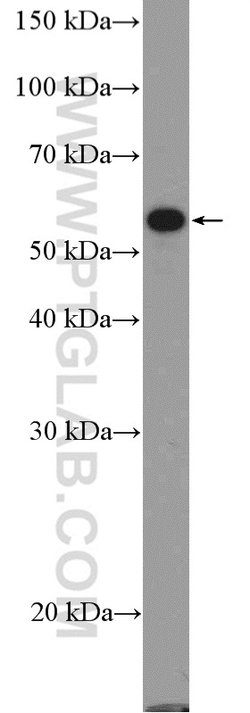 FOXC2 Rabbit anti-Human, Mouse, Rat, Polyclonal, Proteintech 150 &mu;L;