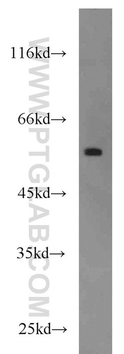 FOXC2 Rabbit anti-Human, Mouse, Rat, Polyclonal, Proteintech 150 &mu;L;