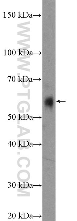 FOXC2 Rabbit anti-Human, Mouse, Rat, Polyclonal, Proteintech 150 &mu;L;