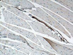 ACTA2/smooth muscle actin Rabbit anti-Human, Mouse, Rat, Polyclonal, Proteintech:Antibodies:Primary
