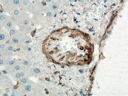 ACTA2/smooth muscle actin Rabbit anti-Human, Mouse, Rat, Polyclonal, Proteintech:Antibodies:Primary