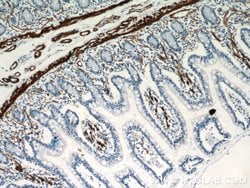 ACTA2/smooth muscle actin Rabbit anti-Human, Mouse, Rat, Polyclonal, Proteintech:Antibodies:Primary