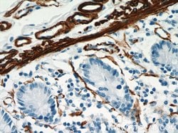 ACTA2/smooth muscle actin Rabbit anti-Human, Mouse, Rat, Polyclonal, Proteintech:Antibodies:Primary