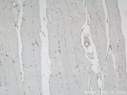 ACTA2/smooth muscle actin Rabbit anti-Human, Mouse, Rat, Polyclonal, Proteintech:Antibodies:Primary