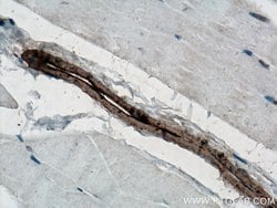 ACTA2/smooth muscle actin Rabbit anti-Human, Mouse, Rat, Polyclonal, Proteintech:Antibodies:Primary