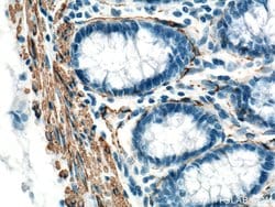 ACTA2/smooth muscle actin Rabbit anti-Human, Mouse, Rat, Polyclonal, Proteintech:Antibodies:Primary