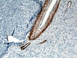 ACTA2/smooth muscle actin Rabbit anti-Human, Mouse, Rat, Polyclonal, Proteintech:Antibodies:Primary