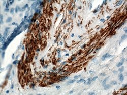 ACTA2/smooth muscle actin Rabbit anti-Human, Mouse, Rat, Polyclonal, Proteintech:Antibodies:Primary
