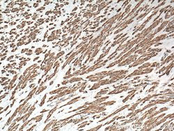 ACTA2/smooth muscle actin Rabbit anti-Human, Mouse, Rat, Polyclonal, Proteintech:Antibodies:Primary