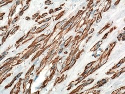 ACTA2/smooth muscle actin Rabbit anti-Human, Mouse, Rat, Polyclonal, Proteintech:Antibodies:Primary