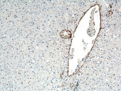 ACTA2/smooth muscle actin Rabbit anti-Human, Mouse, Rat, Polyclonal, Proteintech:Antibodies:Primary