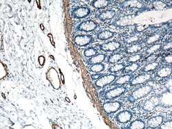 ACTA2/smooth muscle actin Rabbit anti-Human, Mouse, Rat, Polyclonal, Proteintech:Antibodies:Primary