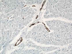 ACTA2/smooth muscle actin Rabbit anti-Human, Mouse, Rat, Polyclonal, Proteintech:Antibodies:Primary