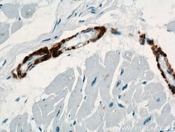 ACTA2/smooth muscle actin Rabbit anti-Human, Mouse, Rat, Polyclonal, Proteintech:Antibodies:Primary