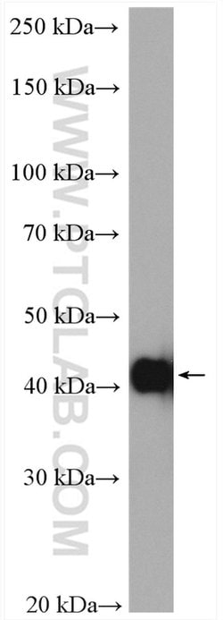 ACTA2/smooth muscle actin Rabbit anti-Human, Mouse, Rat, Polyclonal, Proteintech:Antibodies:Primary