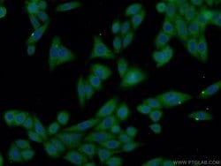 XRN1 Rabbit anti-Human, Mouse, Polyclonal, Proteintech 150 &mu;L; Unconjugated:Antibodies,