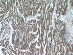 XRN1 Rabbit anti-Human, Mouse, Polyclonal, Proteintech 150 &mu;L; Unconjugated:Antibodies,