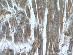 XRN1 Rabbit anti-Human, Mouse, Polyclonal, Proteintech 150 &mu;L; Unconjugated:Antibodies,