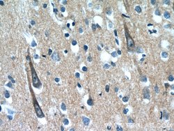 XRN1 Rabbit anti-Human, Mouse, Polyclonal, Proteintech 150 &mu;L; Unconjugated:Antibodies,
