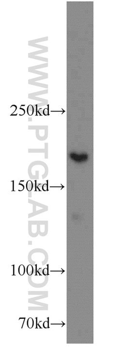 XRN1 Rabbit anti-Human, Mouse, Polyclonal, Proteintech 150 &mu;L; Unconjugated:Antibodies,