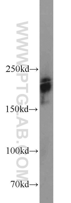 XRN1 Rabbit anti-Human, Mouse, Polyclonal, Proteintech 150 &mu;L; Unconjugated:Antibodies,