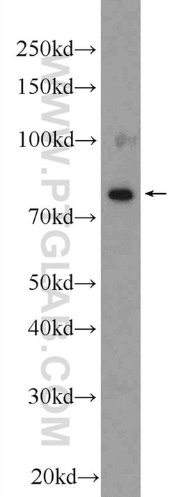 ESRP2 Rabbit anti-Human, Mouse, Polyclonal, Proteintech 150 &mu;L; Unconjugated:Antibodies,