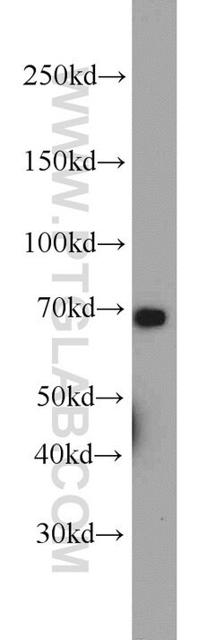 CADM4 Rabbit anti-Human, Mouse, Rat, Polyclonal, Proteintech:Antibodies:Primary