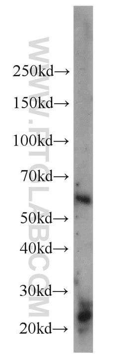 CADM4 Rabbit anti-Human, Mouse, Rat, Polyclonal, Proteintech:Antibodies:Primary