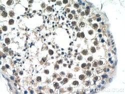 ATXN3L Rabbit anti-Human, Polyclonal, Proteintech 150 &mu;L; Unconjugated:Antibodies,