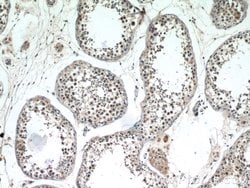 ATXN3L Rabbit anti-Human, Polyclonal, Proteintech 150 &mu;L; Unconjugated:Antibodies,