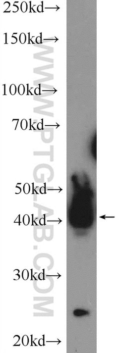 ATXN3L Rabbit anti-Human, Polyclonal, Proteintech 150 &mu;L; Unconjugated:Antibodies,