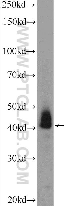 ATXN3L Rabbit anti-Human, Polyclonal, Proteintech 150 &mu;L; Unconjugated:Antibodies,