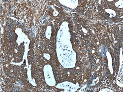 RHBDF2 Rabbit anti-Human, Polyclonal, Proteintech 150 &mu;L; Unconjugated:Antibodies,