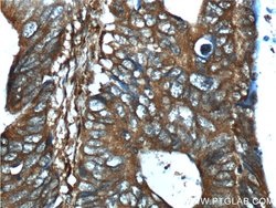 RHBDF2 Rabbit anti-Human, Polyclonal, Proteintech 150 &mu;L; Unconjugated:Antibodies,