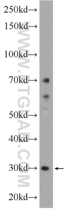 TMEM77 Rabbit anti-Human, Polyclonal, Proteintech 150 &mu;L | Buy Online | Proteintech Group Inc | Fisher Scientific