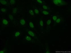 EVI1 Rabbit anti-Human, Polyclonal, Proteintech 150 &mu;L; Unconjugated:Antibodies,