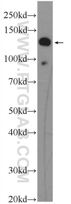 EVI1 Rabbit anti-Human, Polyclonal, Proteintech 150 &mu;L; Unconjugated:Antibodies,