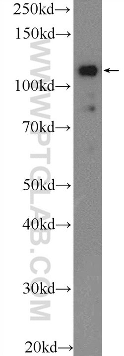 EVI1 Rabbit anti-Human, Polyclonal, Proteintech 150 &mu;L; Unconjugated:Antibodies,