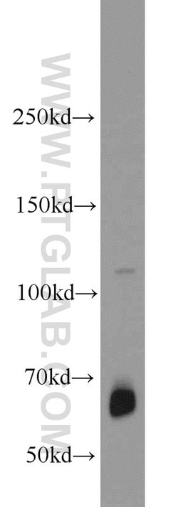 ZGPAT Rabbit anti-Human, Mouse, Polyclonal, Proteintech 150 &mu;L; Unconjugated:Antibodies,