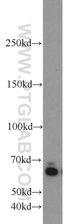 ZGPAT Rabbit anti-Human, Mouse, Polyclonal, Proteintech 150 &mu;L; Unconjugated:Antibodies,