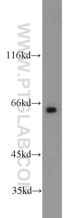 LRRC47 Rabbit anti-Human, Mouse, Rat, Polyclonal, Proteintech 150 &mu;L;