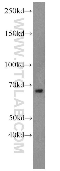 LRRC47 Rabbit anti-Human, Mouse, Rat, Polyclonal, Proteintech 150 &mu;L;