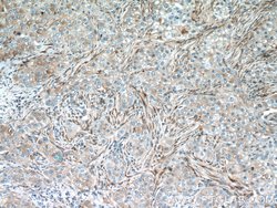 IFIT1 Rabbit anti-Human, Mouse, Rat, Polyclonal, Proteintech:Antibodies:Primary