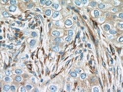 IFIT1 Rabbit anti-Human, Mouse, Rat, Polyclonal, Proteintech:Antibodies:Primary