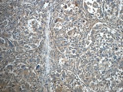 IFIT1 Rabbit anti-Human, Mouse, Rat, Polyclonal, Proteintech:Antibodies:Primary