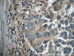 IFIT1 Rabbit anti-Human, Mouse, Rat, Polyclonal, Proteintech:Antibodies:Primary